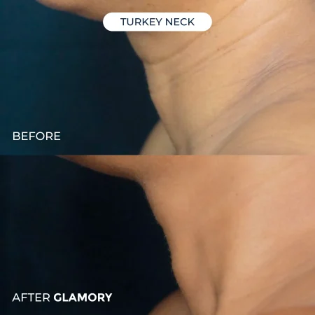 Glamory