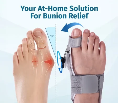Treatmedy Bunion Fix